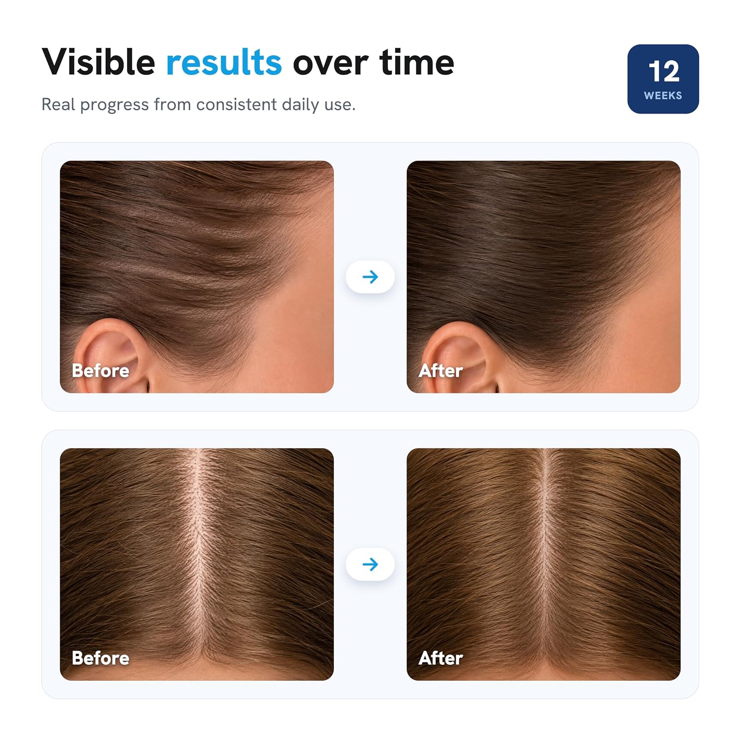 Precision Scalp Regrowth Roll-On Serum